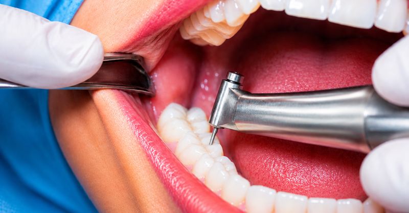 Cirugía Maxilofacial
