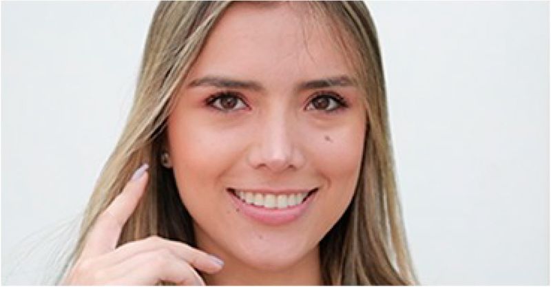 Diseño de sonrisa